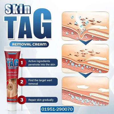 Ethereal Skin Tag Removal Cream_img_1
