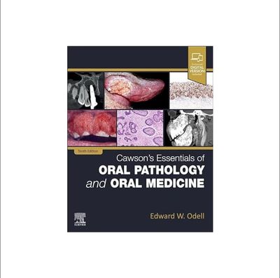 Cawson's Essentials of Oral Pathology and Oral Medicine_img_0