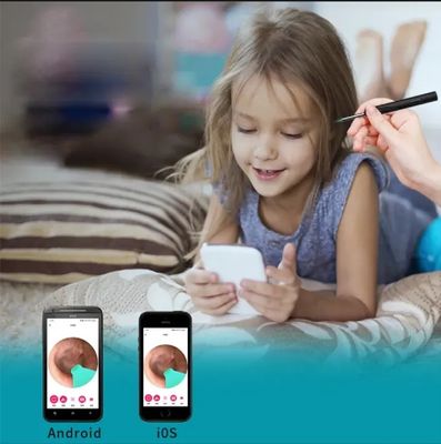 Smart Visual intelligent Ear Cleaner earpick NE series High Precision Ear Wax Removal beauty Tool with Camera LED Light Wireless Otoscope Smart Ear Cleaning Kit_img_8