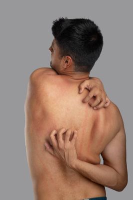 Permimite lotion 2 pcs & scrabic soap 1 pcs_img_4