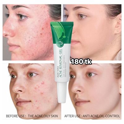 NS4810-Acnee Removal Gel_img_5