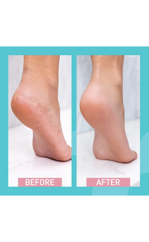 Siodil Daily Cracked Heels Cream 40 ml - Image 6