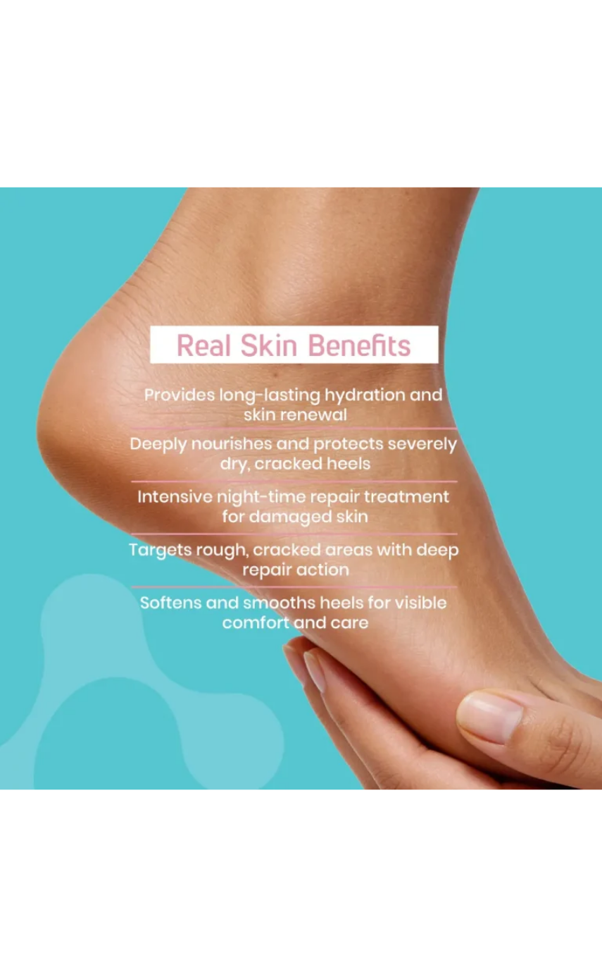 Siodil Daily Cracked Heels Cream 40 ml - Image 4