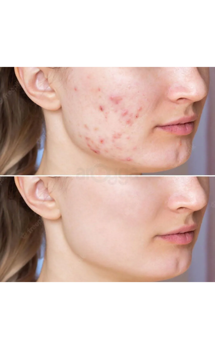 Earth Beauty & You Cica care + Barrier Repair Toner Anti-Acne Derma Solution 220ml - Image 4