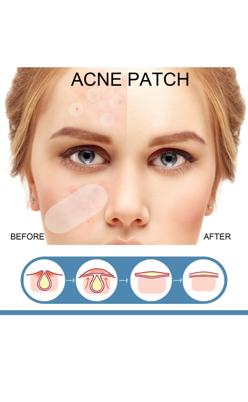 Earth Beauty & You Cica care+ Barrier Repair Acne Treatment Serum - Image 3