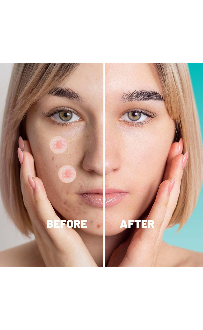 Earth Beauty & You Cica care+ Barrier Repair Acne Treatment Serum - Image 4