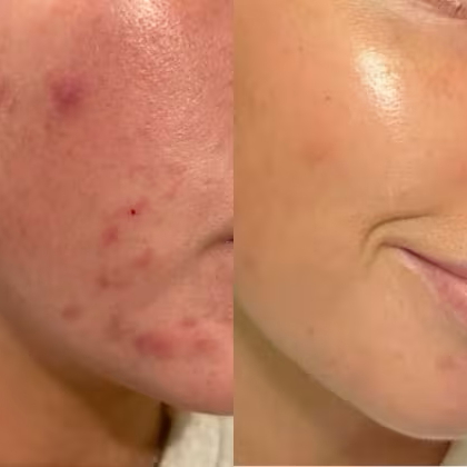 PAULA’S CHOICE – 2% BHA Liquid Exfoliant_img_4