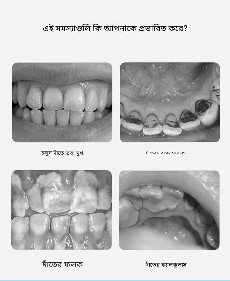 Dental Stain Removal Oral Care Tool_img_1