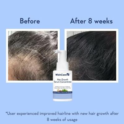 WishCare Hair Growth Serum Concentrate - 30 ml_img_1