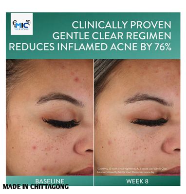 Cetaphil Gentle Clear Clarifying Acne Cream Cleanser 124ml_img_3
