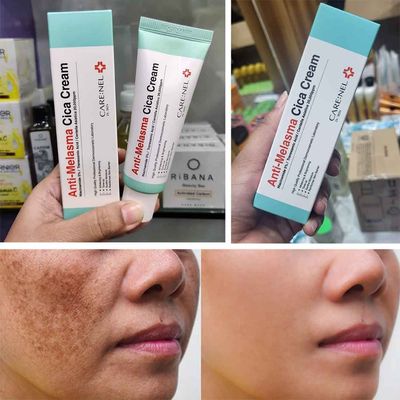 Care:Nel Anti-Melasma Cica Cream_img_4