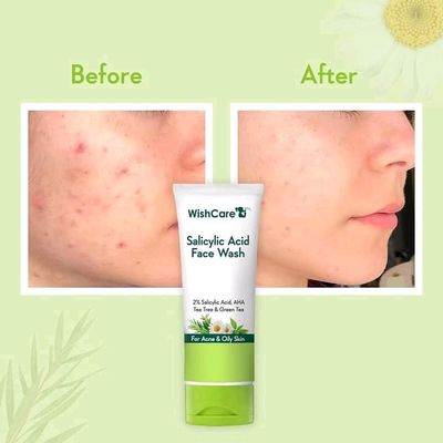 WishCare 2% Salicylic Acid Face Wash 100ml_img_2
