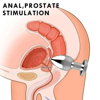 Wireless Remote Control Anal Vibrator Metal Butt Plug Men Prostate Massager Female Masturbator Adult Sex Toys for Women Men Gay_img_2