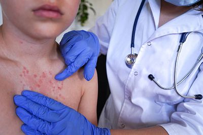 Permimte Medicated Soap [ Indian ]_img_3