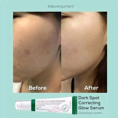 Axis-Y dark spot serum5ml made in Korea_img_3