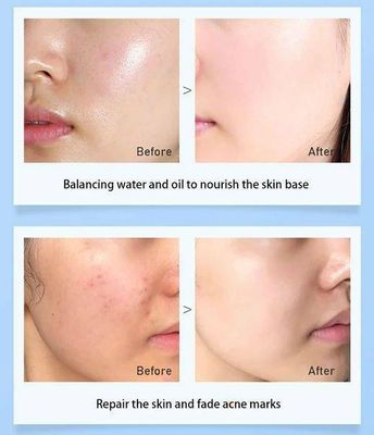 OSUFI Whitening Essence Spray Remove Melanin Fade Spots Facial Moisturizing Dissolution Freckle Face Serum Skin Care ProductsNET WT : 60ml_img_3