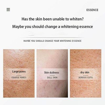 OSUFI Whitening Essence Spray Remove Melanin Fade Spots Facial Moisturizing Dissolution Freckle Face Serum Skin Care ProductsNET WT : 60ml_img_6