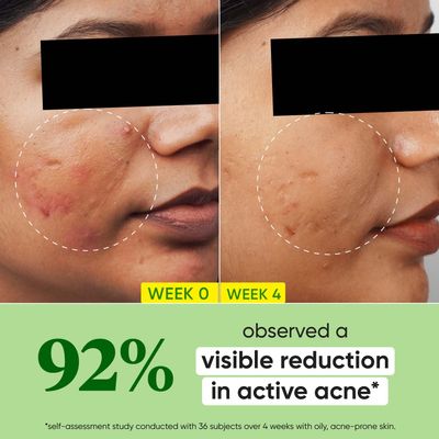 Dot & Key Cica + 2% Salicylic Acid Serum for Acne & Oil Control_img_3