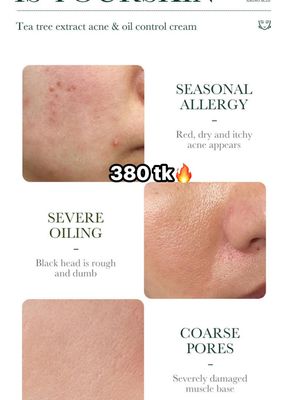 Tea Tree Acnee Oil Control Cream-NS4504_img_2