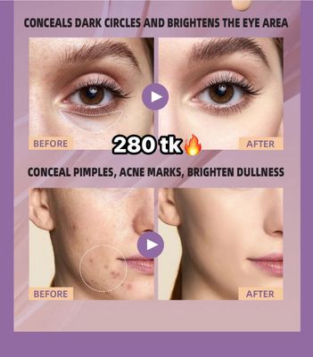 Quibest Concelar -NS4506_img_6