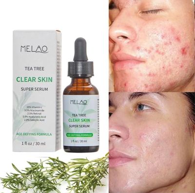 Melao Tea Tree Clear Skin Super Serum