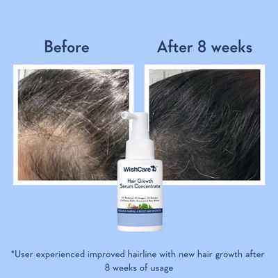 Hair Growth Serum Concentrate With 3% Redensyl, 4% Anagain, Rice Water, Biotin._img_1
