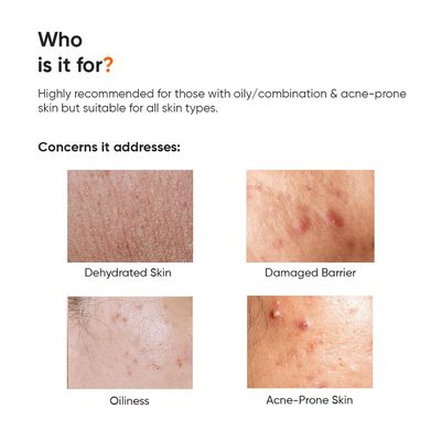 Minimalist 10% Vitamin B5 Moisturizer – For Dehydrated Skin & Damaged Barrier Repair_img_2