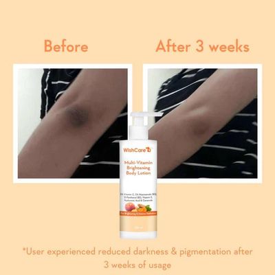 WishCare Multi Vitamin Brightening Body Lotion 200ml_img_2