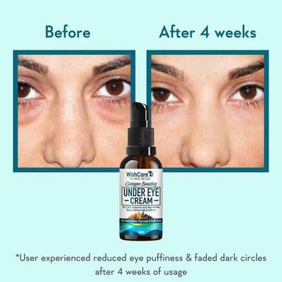 WishCare Collagen Boosting Under Eye Cream - 30ml_img_2