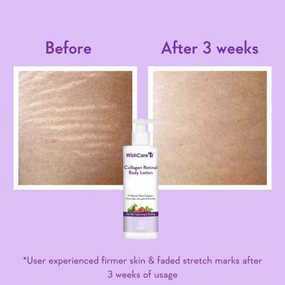 WishCare Collagen 1% Retinol Body Lotion | 200ml_img_2