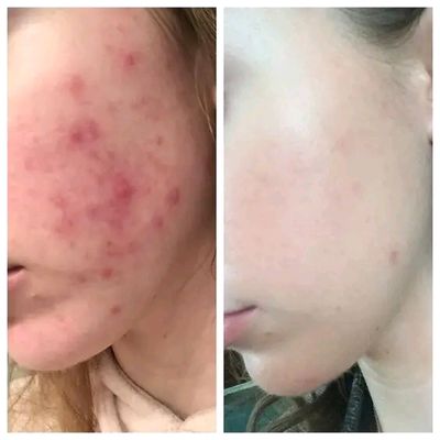 Bioaqua pure skin serum_img_2