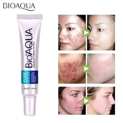 BIOAQUA PURE SKIN ACNE REMOVAL CREAM_img_0