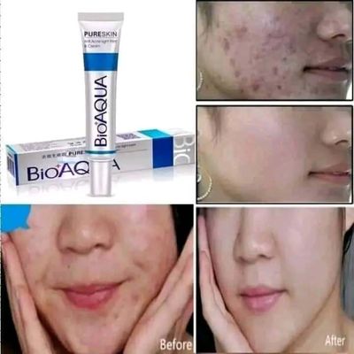 BIOAQUA PURE SKIN ACNE REMOVAL CREAM_img_1
