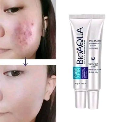 BIOAQUA PURE SKIN ACNE REMOVAL CREAM_img_2