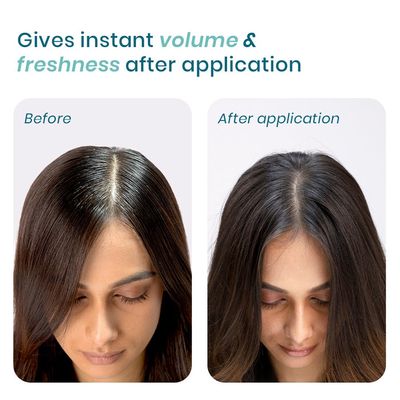 Wishcare Air Powder Dry Shampoo for Oily Hair & Scalp - 10g_img_2