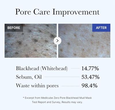 Medicube Zero Pore Blackhead Mud Facial Mask - 100g_img_4
