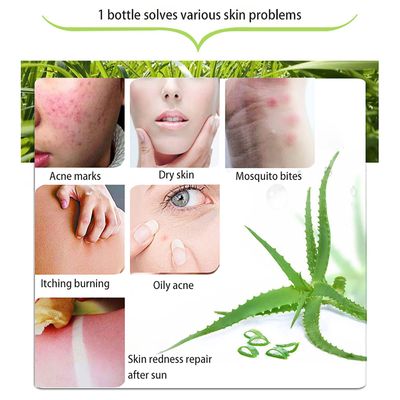 Smoothing & Moisture Aloe Vera 99% Soothing Gel, 300g_img_2