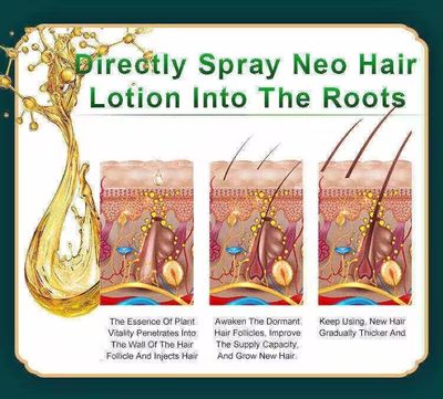 Neo Hair Lotion (Green Wealth)_img_2