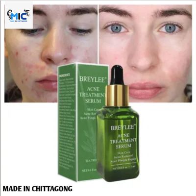 Breylee Acne Treatment Serum Facial - 17 ml_img_1