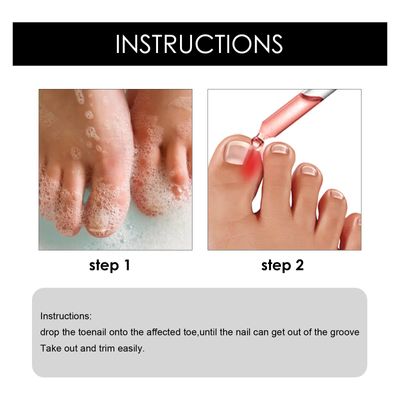Toenail Pain Relief Kit and Fabric Softener 10ml_img_6