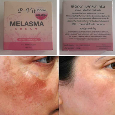Bioaqua P Vita Melasma Mesta Whitening Cream -10 gm (Thailand)_img_4