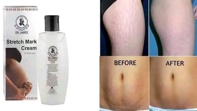 Dr.James Stretch Mark Cream(200ml)_img_2