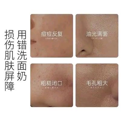 Osufi 𝐕𝐢𝐭𝐚𝐦𝐢𝐧 𝐁𝟓 𝐒𝐚𝐥𝐢𝐜𝐲𝐥𝐢𝐜 𝐀𝐜𝐢𝐝 𝐁𝐫𝐢𝐠𝐡𝐭𝐞𝐧 𝐅𝐚𝐜𝐞 𝐖𝐚𝐬𝐡 - 𝟏𝟎𝟎𝐠𝐦_img_3