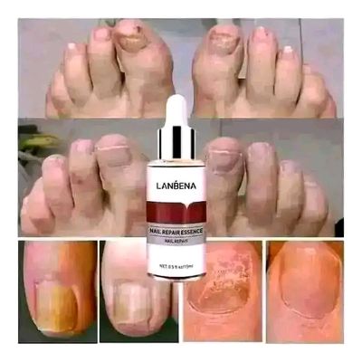 LANBENA Nail Repair Essence Serum-15ml_img_1