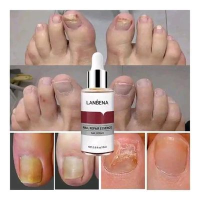 LANBENA Nail Repair Essence Serum-15ml_img_3