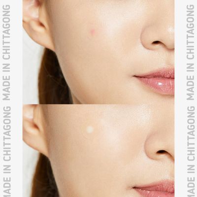 Cosrx Acne Pimple Master Patch_img_5