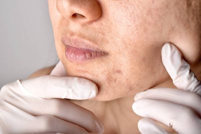 AXIS - Y Dark Spot Correcting Glow Cream[Korean]_img_6