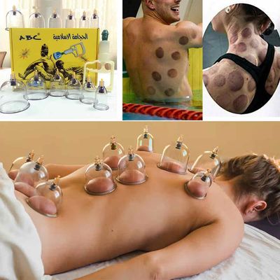 Hijama Cupping Set 12 Pcs – Glass & Plastic Therapy Cups | Sunnah Cupping for Pain Relief, Detox, & Muscle Relaxation_img_2