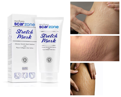 Provamed  Scarzone Stretch Mark Cream 200 ml_img_0