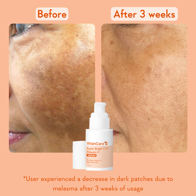 Super Bright Vitamin C16 Serum_img_2